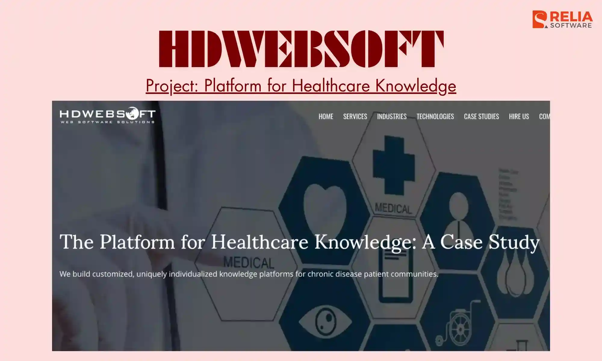 cms development company hdwebsoft